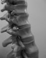 Osteopatia